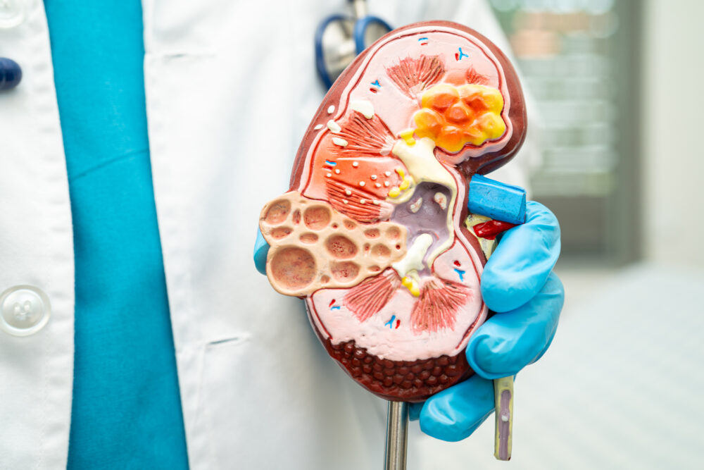 CKD